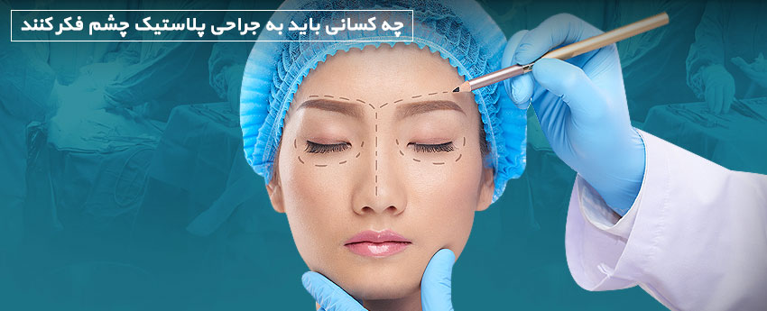 چه کسانی باید به جراحی پلاستیک چشم فکر کنند