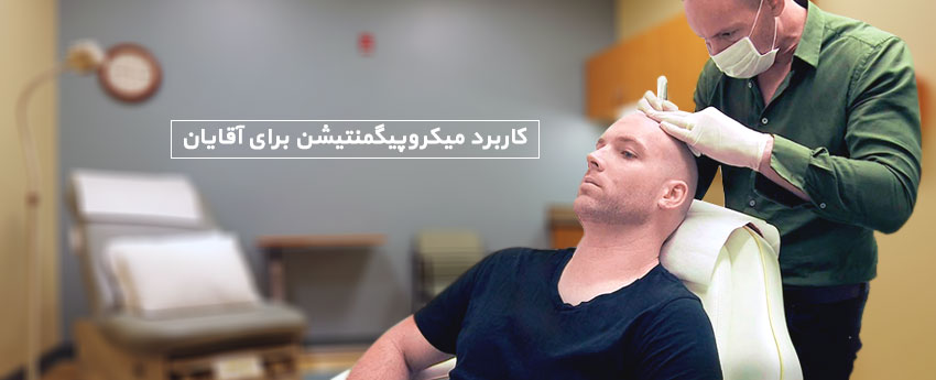 کاربرد میکروپیگمنتیشن برای آقایان