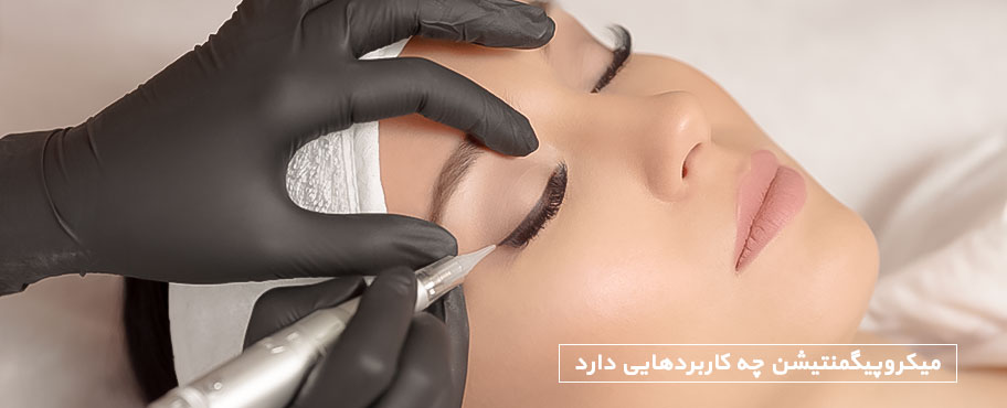 کاربردهای مختلف میکروپیگمنتیشن