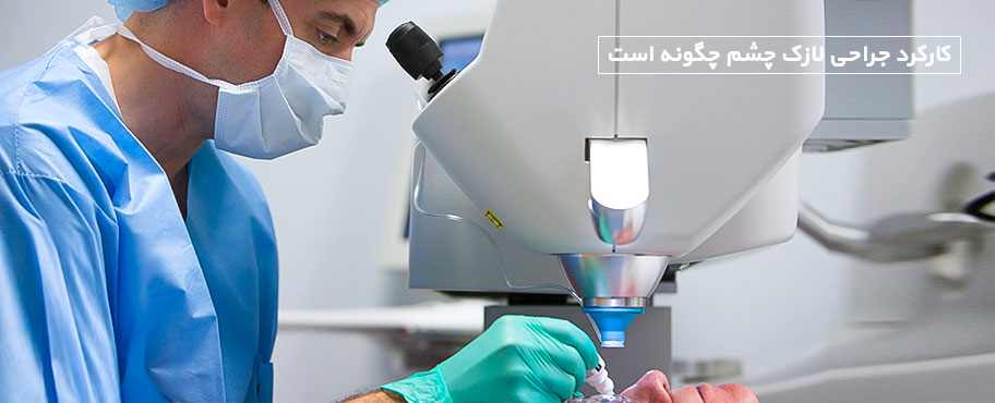 کارکرد جراحی لازک چشم چگونه است